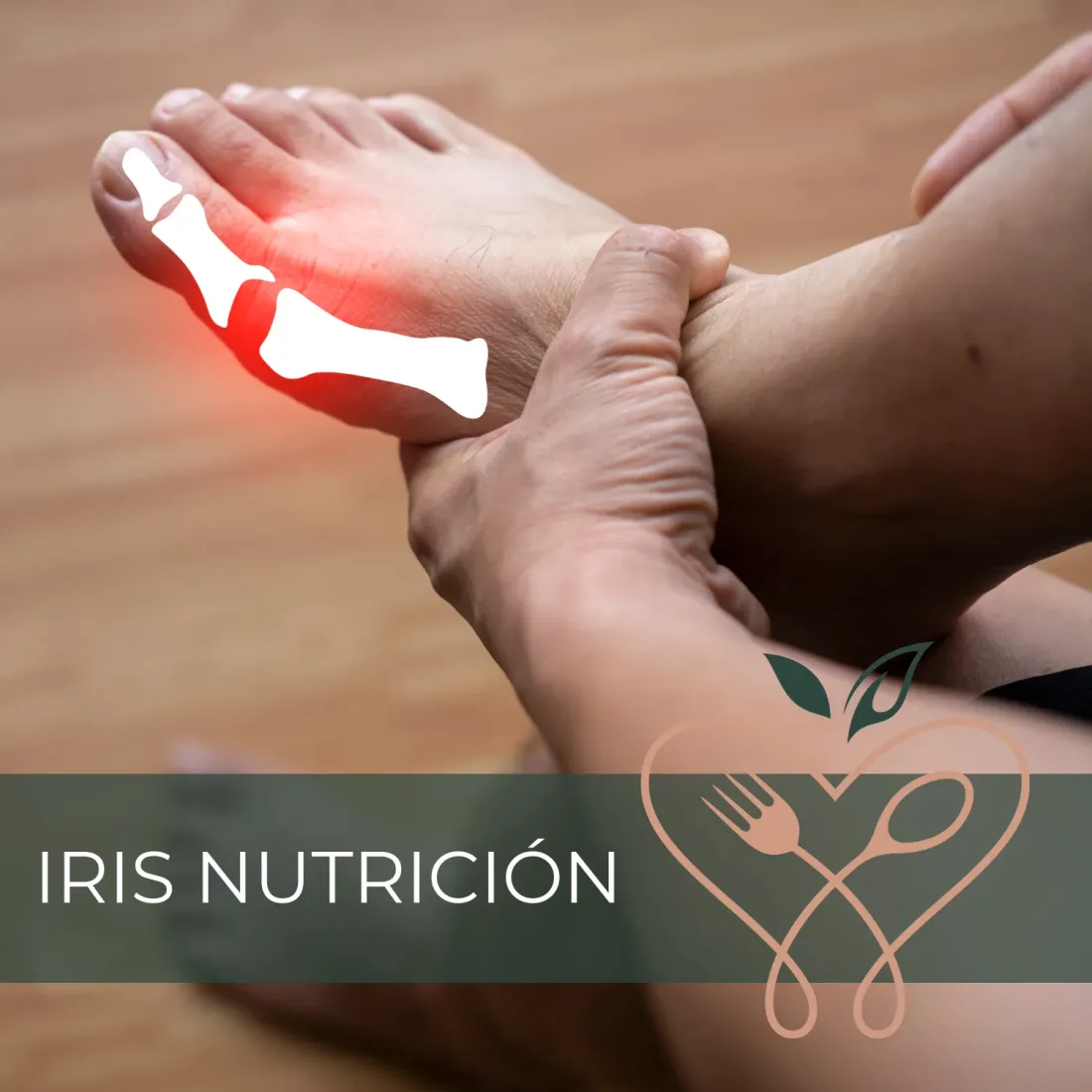 Cómo bajar el ácido úrico rápidamente